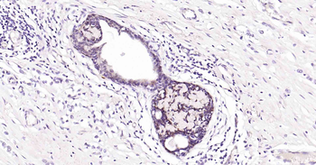 NSE Recombinant Rabbit Monoclonal Antibody