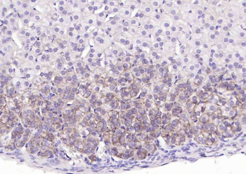 ATP1A1 Rabbit Polyclonal Antibody