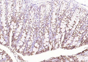 ATP1A1 Rabbit Polyclonal Antibody