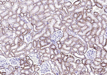 ATP1A1 Rabbit Polyclonal Antibody
