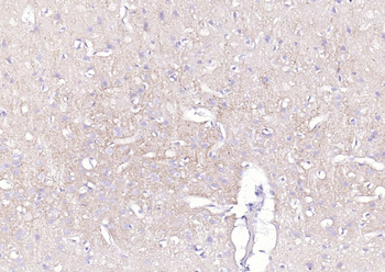 ATP1A1 Rabbit Polyclonal Antibody