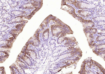 ATP1A1 Rabbit Polyclonal Antibody
