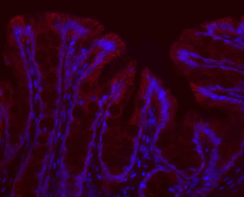 ATP1A1 Rabbit Polyclonal Antibody