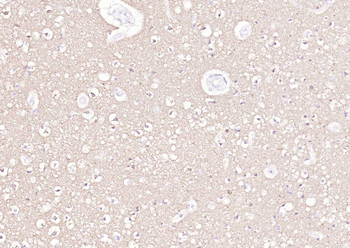 ATP1A1 Rabbit Polyclonal Antibody