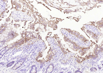 ATP1A1 Rabbit Polyclonal Antibody