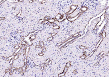 ATP1A1 Rabbit Polyclonal Antibody