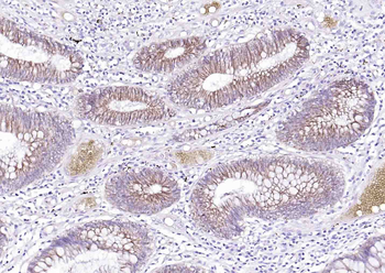ATP1A1 Rabbit Polyclonal Antibody