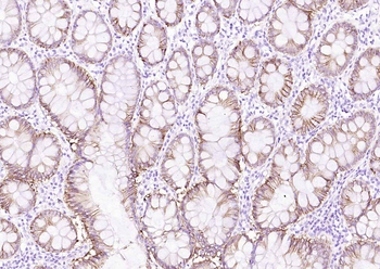 ATP1A1 Rabbit Polyclonal Antibody