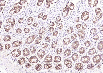 ATP1A1 Rabbit Polyclonal Antibody