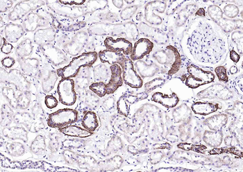 ATP1A1 Rabbit Polyclonal Antibody