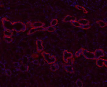 ATP1A1 Rabbit Polyclonal Antibody