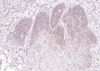 ATP1A1 Rabbit Polyclonal Antibody