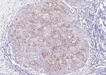 ATP1A1 Rabbit Polyclonal Antibody