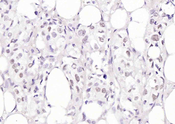 Cyclin G Rabbit Polyclonal Antibody