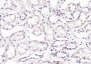 Cyclin G Rabbit Polyclonal Antibody