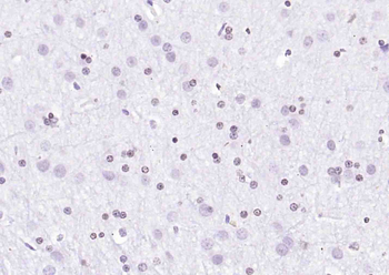 Cyclin G Rabbit Polyclonal Antibody
