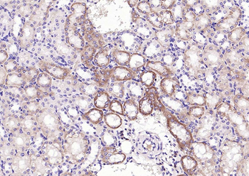 UCHL1+3 Rabbit Polyclonal Antibody