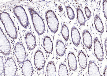 RPL5 Rabbit Polyclonal Antibody