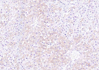 IL-1 Beta Rabbit Polyclonal Antibody