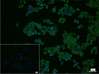 LAMP1 Rabbit Polyclonal Antibody
