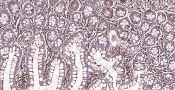 LAMP1 Rabbit Polyclonal Antibody