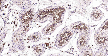 LAMP1 Rabbit Polyclonal Antibody