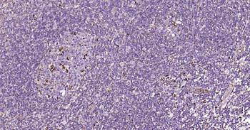 LAMP1 Rabbit Polyclonal Antibody