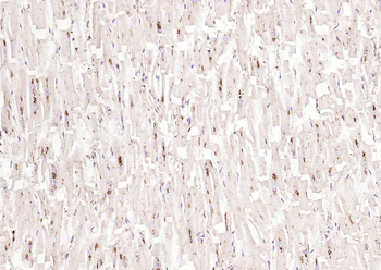 LAMP1 Rabbit Polyclonal Antibody