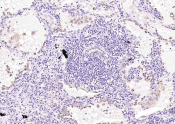 LAMP1 Rabbit Polyclonal Antibody