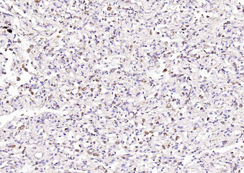 LAMP1 Rabbit Polyclonal Antibody
