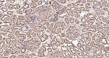 LAMP1 Rabbit Polyclonal Antibody