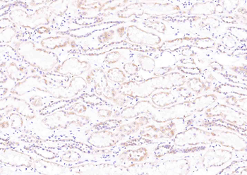 ENOS Rabbit Polyclonal Antibody