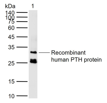 PTH/Parathyroid hormone Rabbit Polyclonal Antibody