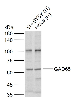 GAD65 Rabbit Polyclonal Antibody