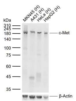 C-Met Recombinant Rabbit Monoclonal Antibody