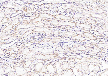 Bim Rabbit Polyclonal Antibody