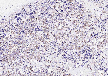 Cytokeratin 8 Rabbit Polyclonal Antibody