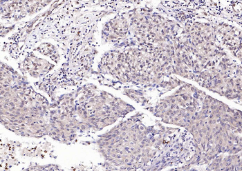 USP34 Rabbit Polyclonal Antibody