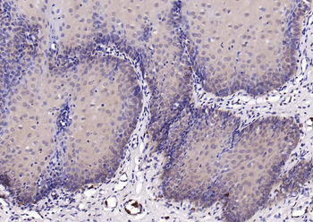 USP34 Rabbit Polyclonal Antibody