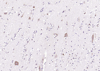 FMN1 Rabbit Polyclonal Antibody