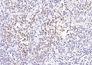 IL-18 Rabbit Polyclonal Antibody