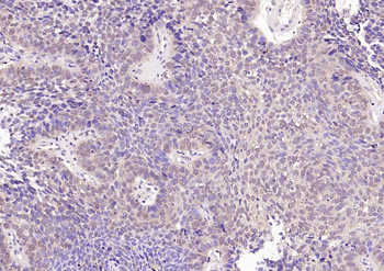 VEGFR3 Rabbit Polyclonal Antibody