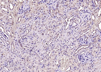 VEGFR3 Rabbit Polyclonal Antibody