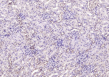 VEGFR3 Rabbit Polyclonal Antibody