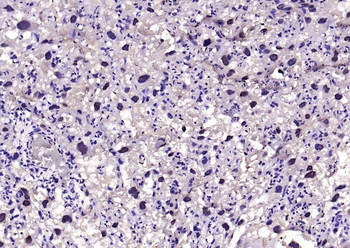 VEGFR3 Rabbit Polyclonal Antibody