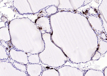 Procalcitonin (PCT) Mouse Monoclonal Antibody