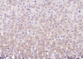 AMHR2 Rabbit Polyclonal Antibody