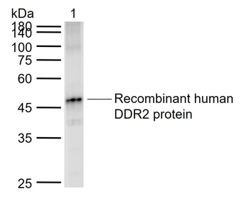 DDR2 Rabbit Polyclonal Antibody