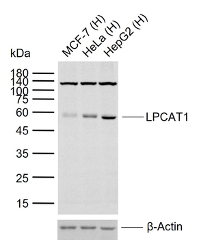 LPCAT1 Rabbit Polyclonal Antibody