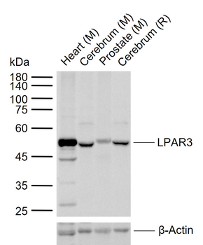 LPAR3 Rabbit Polyclonal Antibody